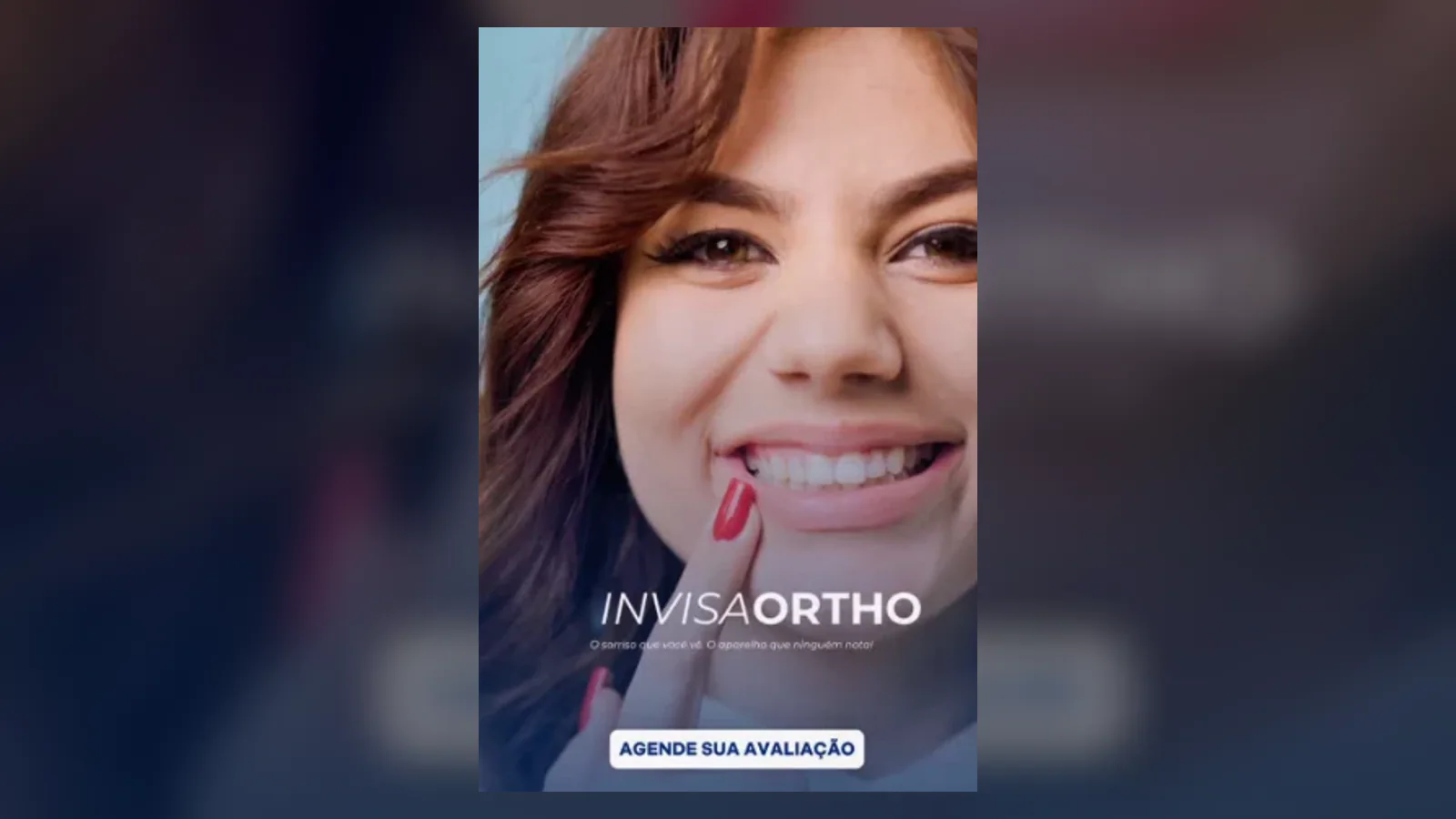 Banner do artigo Aparelhos estéticos: como alinhar os dentes com mais discrição
