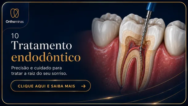 Tratamento endodôntico