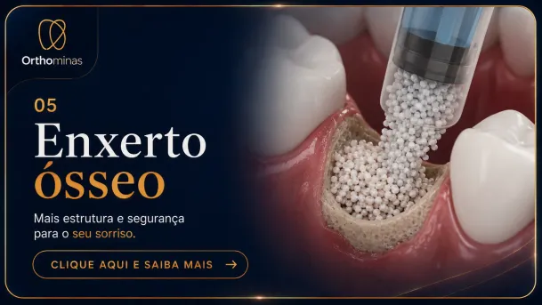 Enxerto ósseo